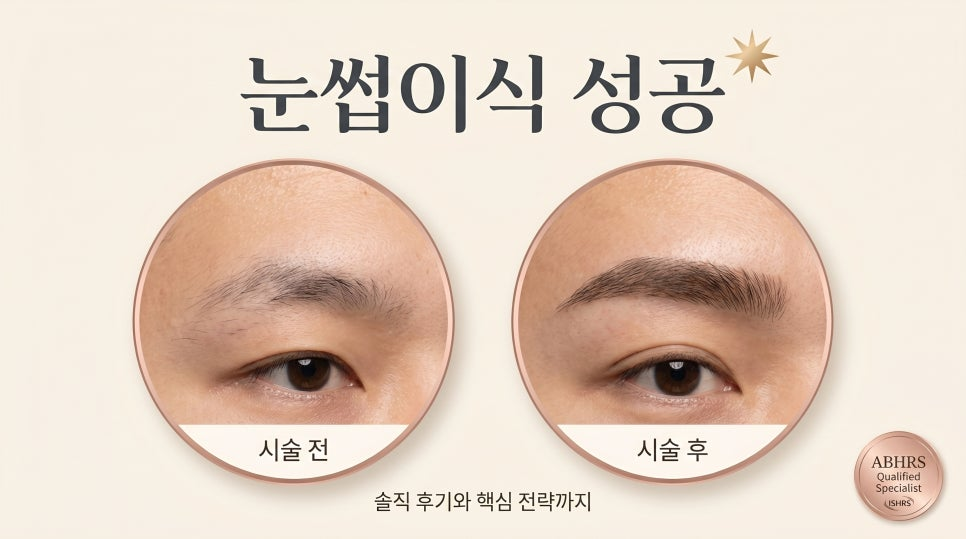 눈썹이식 전후 비교