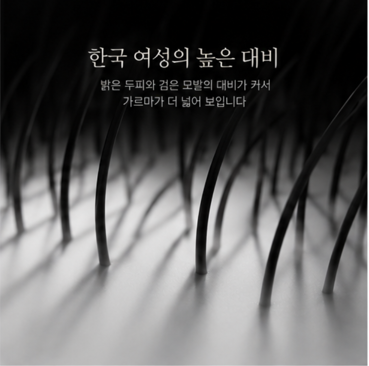 여성의 탈모는